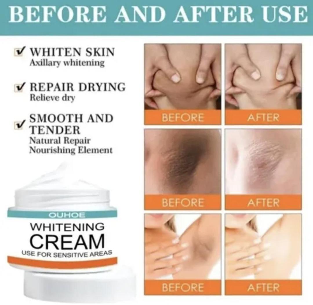 Private part whitening cream